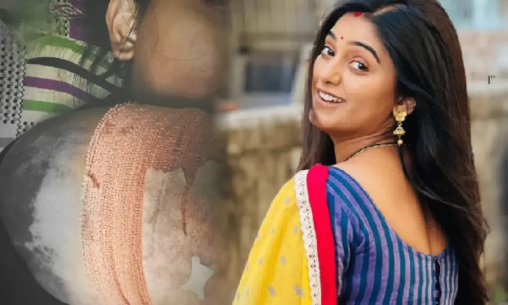 accident, Bengali actress, dipanwita rakshit, দীপান্বিতা রক্ষিত, বাঙালি অভিনেত্রী দীপান্বিতা রক্ষিত, বাঙালি অভিনেত্রী, Bengali actress, Dipanwita Rakshit, accident