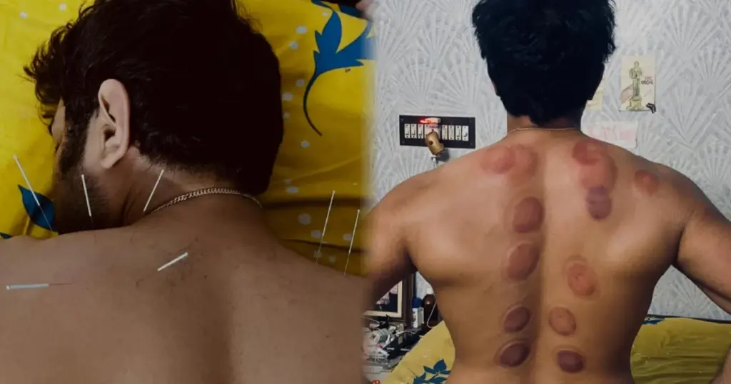 জিতু কামাল, Jeetu Kamal, কাপিং থেরাপি, Cupping Therapy, নিডিল থেরাপি, Needle Therapy, টলিউড অভিনেতা, Tollywood Actor, চিরদিনই তুমি যে আমার, Bengali TV Serial, বাংলা ধারাবাহিক, TRP, সোশ্যাল মিডিয়া, Social Media, অভিনেতার আপডেট, Celebrity Health, এরাও মানুষ, Eraw Manush Movie, শ্রাবন্তী চট্টোপাধ্যায়, Srabanti Chatterjee