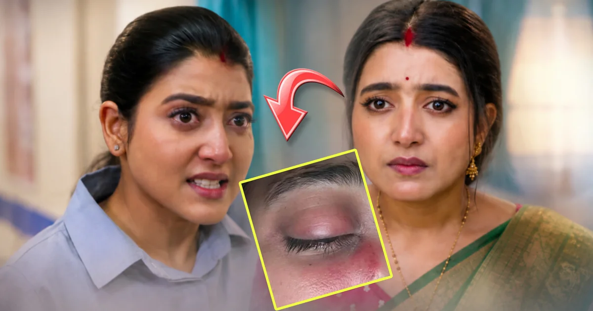 aratrika maity eye injury shooting jowar bhanta